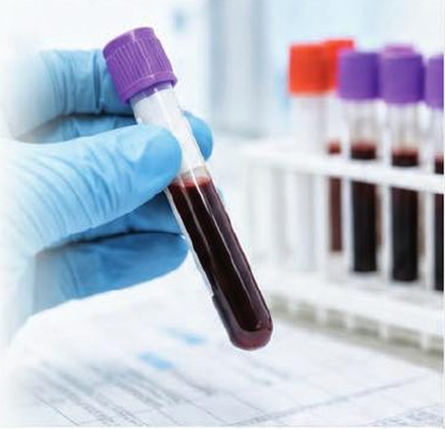 Laboratory Bloods