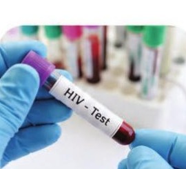 STI & HIV Testing and Treatment